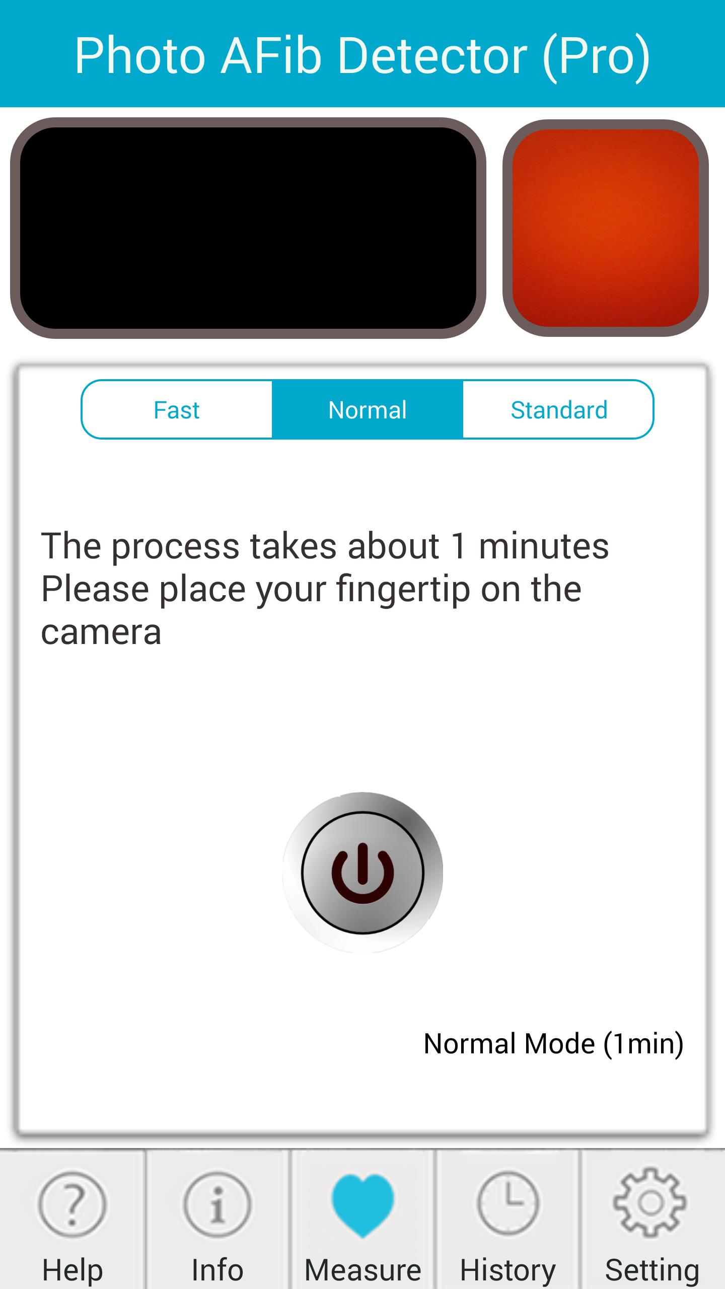 Photo AFib Detector